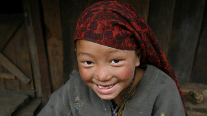 Cleft Palate Reconstruction Surgery